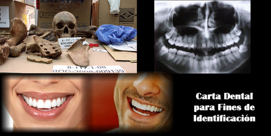 Ley 38 de 1993 en Colombia, Carta Dental para Fines de Identificación
