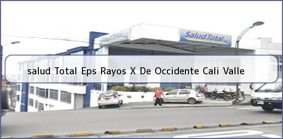Ver salud total eps rayos x de occidente cali valle <b>salud Total Eps Rayos X De Occidente Cali Valle</b>