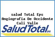 Ver salud total eps angiografia de occidente cali valle <i>salud Total Eps Angiografia De Occidente Cali Valle</i>