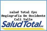 <i>salud Total Eps Angiografia De Occidente Cali Valle</i>