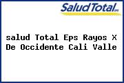 Ver salud total eps rayos x de occidente cali valle <i>salud Total Eps Rayos X De Occidente Cali Valle</i>