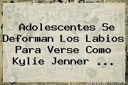 Adolescentes Se Deforman Los Labios Para Verse Como <b>Kylie Jenner</b> <b>...</b>