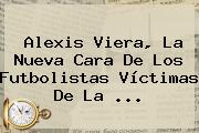 Ver alexis viera la nueva cara de los futbolistas victimas de la <b>Alexis Viera</b>, La Nueva Cara De Los Futbolistas Víctimas De La <b>...</b>