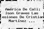 <b>América De Cali</b>: ¿son Graves Las Lesiones De Cristian Martínez ...