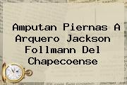 Amputan Piernas A Arquero <b>Jackson Follmann</b> Del Chapecoense