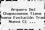 <b>Arquero</b> Del <b>Chapecoense</b> Tiene Buena Evolución Tras Nueva Ci ...