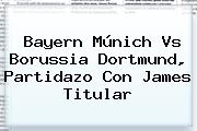 <b>Bayern Múnich</b> Vs Borussia Dortmund, Partidazo Con James Titular