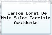 Carlos <b>Loret De Mola</b> Sufre Terrible Accidente