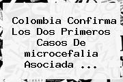 Colombia Confirma Los Dos Primeros Casos De <b>microcefalia</b> Asociada <b>...</b>