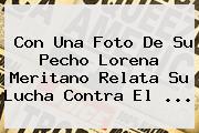 Con Una Foto De Su Pecho <b>Lorena Meritano</b> Relata Su Lucha Contra El ...