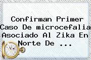 Confirman Primer Caso De <b>microcefalia</b> Asociado Al Zika En Norte De <b>...</b>