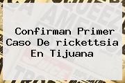 Confirman Primer Caso De <b>rickettsia</b> En Tijuana