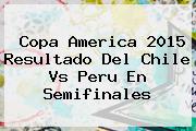 Copa America 2015 Resultado Del <b>Chile Vs Peru</b> En Semifinales