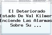 El Deteriorado Estado De <b>Val Kilmer</b> Enciende Las Alarmas Sobre Su <b>...</b>