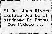 El Dr. Juan Rivera Explica Qué Es El <b>síndrome De Patau</b> Que Padece ...