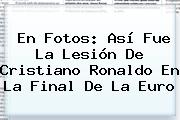 En Fotos: Así Fue La Lesión De <b>Cristiano Ronaldo</b> En La Final De La Euro