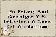 En Fotos: <b>Paul Gascoigne</b> Y Su Deterioro A Causa Del Alcoholismo