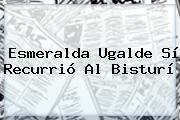 Ver esmeralda ugalde si recurrio al bisturi <b>Esmeralda Ugalde</b> Sí Recurrió Al Bisturí