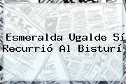 <b>Esmeralda Ugalde</b> Sí Recurrió Al Bisturí