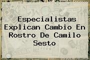 Especialistas Explican Cambio En Rostro De <b>Camilo Sesto</b>