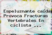Espeluznante <b>caída</b> Provoca Fracturas Vertebrales En <b>ciclista</b> ...