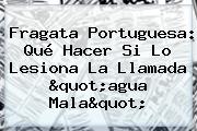 <b>Fragata Portuguesa</b>: Qué Hacer Si Lo Lesiona La Llamada "agua Mala"
