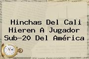Hinchas Del <b>Cali</b> Hieren A Jugador Sub-20 Del <b>América</b>
