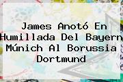 James Anotó En Humillada Del <b>Bayern Múnich</b> Al Borussia Dortmund