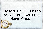 <b>James</b> Es El Unico Que Tiene Chispa Hugo Gatti