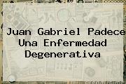 <b>Juan Gabriel</b> Padece Una Enfermedad Degenerativa