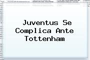 <b>Juventus</b> Se Complica Ante Tottenham