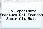 La Impactante Fractura Del Francés <b>Samir Ait Said</b>