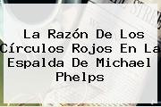 La Razón De Los Círculos Rojos En La Espalda De <b>Michael Phelps</b>