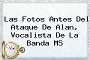 Las Fotos Antes Del Ataque De Alan, Vocalista De La <b>Banda MS</b>
