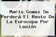 <b>Mario Gomez</b> Se Perderá El Resto De La Eurocopa Por Lesión
