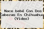 Nace <b>bebé Con Dos Cabezas</b> En Chihuahua (Video)