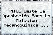 <b>NICE</b> Emite La Aprobación Para La Ablación Mecanoquímica ...