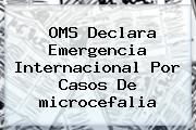OMS Declara Emergencia Internacional Por Casos De <b>microcefalia</b>