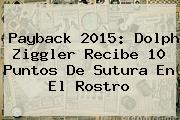 <b>Payback 2015</b>: Dolph Ziggler Recibe 10 Puntos De Sutura En El Rostro