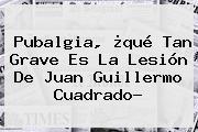 <b>Pubalgia</b>, ¿qué Tan Grave Es La Lesión De Juan Guillermo Cuadrado?