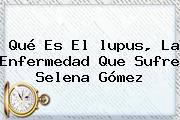 Qué Es El <b>lupus</b>, La Enfermedad Que Sufre Selena Gómez