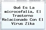 Qué Es La <b>microcefalia</b>, El Trastorno Relacionado Con El Virus Zika