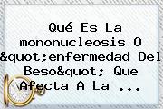 Qué Es La <b>mononucleosis</b> O "enfermedad Del Beso" Que Afecta A La ...