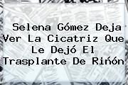 <b>Selena Gómez</b> Deja Ver La Cicatriz Que Le Dejó El Trasplante De Riñón