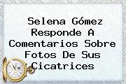 <b>Selena Gómez</b> Responde A Comentarios Sobre Fotos De Sus Cicatrices