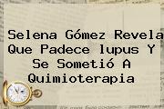 Selena Gómez Revela Que Padece <b>lupus</b> Y Se Sometió A Quimioterapia