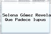 Selena Gómez Revela Que Padece <b>lupus</b>