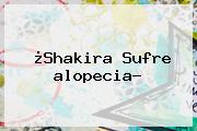 ¿Shakira Sufre <b>alopecia</b>?