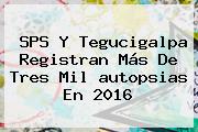Ver sps y tegucigalpa registran mas de tres mil autopsias en 2016 SPS Y Tegucigalpa Registran Más De Tres Mil <b>autopsias</b> En 2016